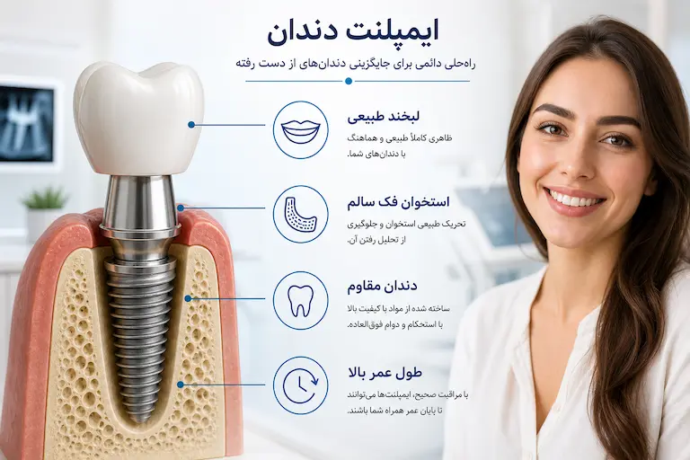 ایمپلنت دندان 2 مزایای ایمپلنت دندان برای جایگزینی دندان از دست رفته