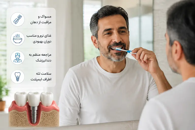 ایمپلنت دندان 10 مراقبتهای بعد از ایمپلنت دندان برای افزایش ماندگاری درمان