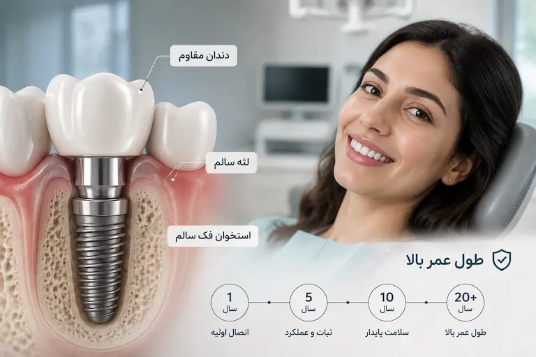 ایمپلنت دندان 8 ماندگاری و طول عمر ایمپلنت دندان در مقایسه با روشهای دیگر