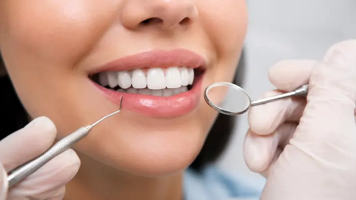 لمینت یا کامپوزیت مقایسه تفاوت، هزینه، ماندگاری و انتخاب بهترین روش 3 نمای نزدیک لمینت سرامیکی دندان با ظاهر طبیعی