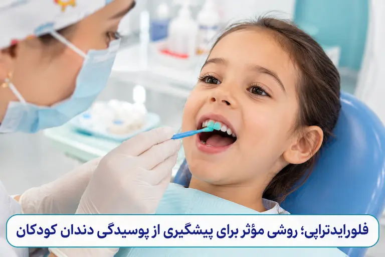 دندانپزشک کودکان 2 فلورایدتراپی برای پیشگیری از پوسیدگی دندان کودکان