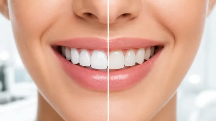 لمینت یا کامپوزیت مقایسه تفاوت، هزینه، ماندگاری و انتخاب بهترین روش 2 لمینت یا کامپوزیت