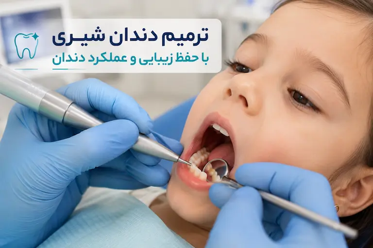 دندانپزشک کودکان 4 ترمیم دندان شیری کودک با مواد همرنگ دندان
