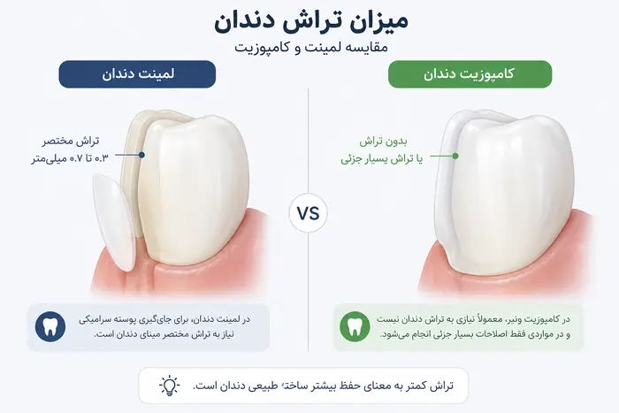 لمینت یا کامپوزیت مقایسه تفاوت، هزینه، ماندگاری و انتخاب بهترین روش 7 مقایسه میزان تراش دندان در لمینت و کامپوزیت