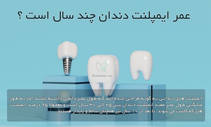 ایمپلنت دندان