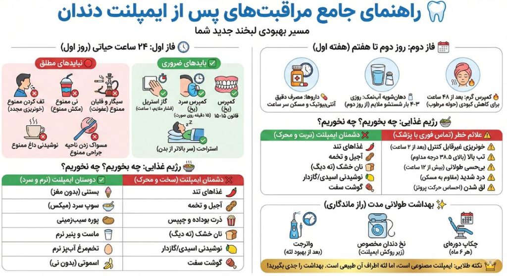 ایمپلنت دندان