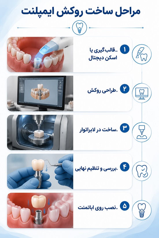 انواع روکش ایمپلنت