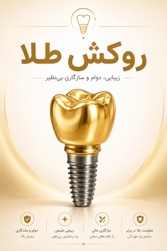 انواع روکش ایمپلنت