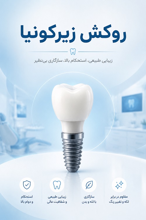 انواع روکش ایمپلنت