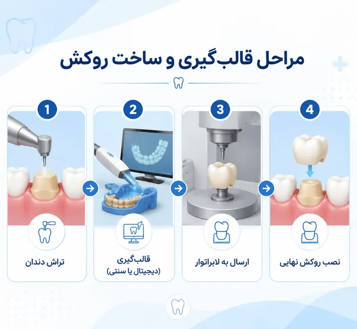 روکش زیرکونیا یا pfm