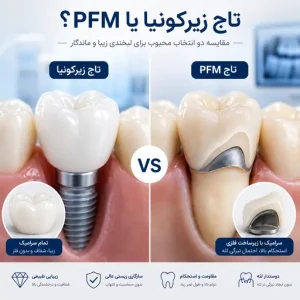 روکش زیرکونیا بهتر است یا PFM؟ مقایسه قیمت، زیبایی و دوام