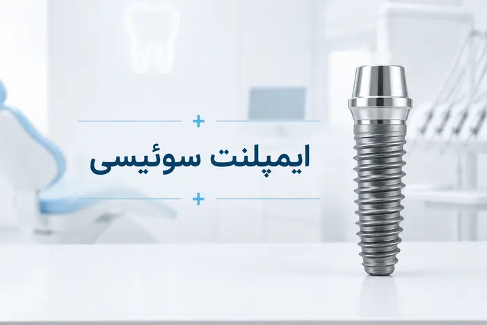 مزایا و معایب ایمپلنت