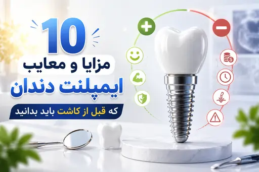 مزایا و معایب ایمپلنت