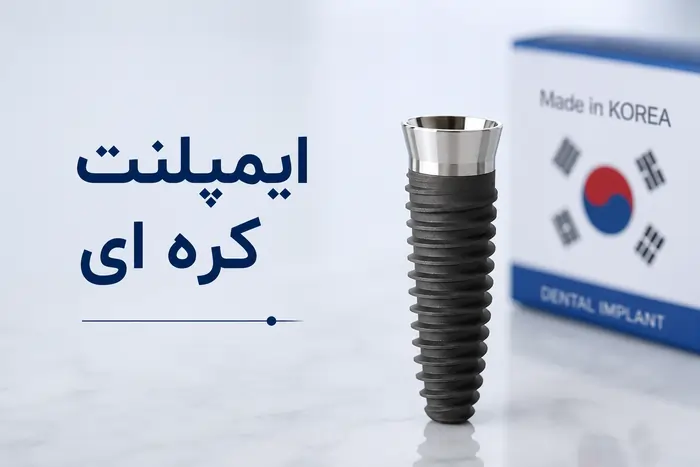 مزایا و معایب ایمپلنت