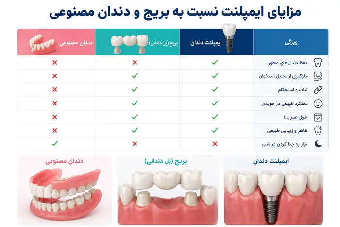 مزایا و معایب ایمپلنت