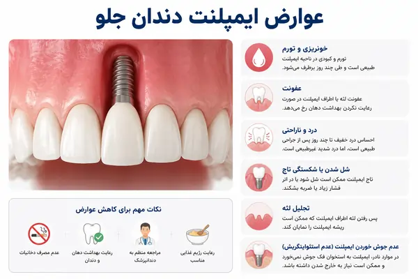 مزایا و معایب ایمپلنت