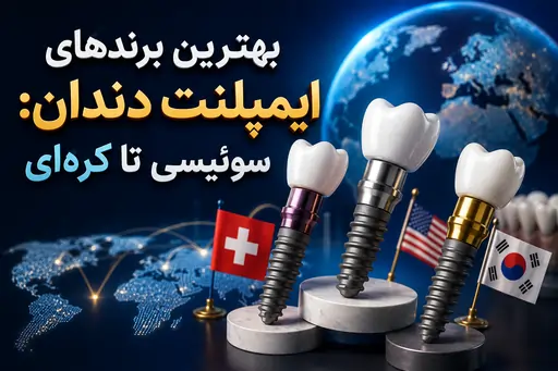 بهترین برندهای ایمپلنت دندان