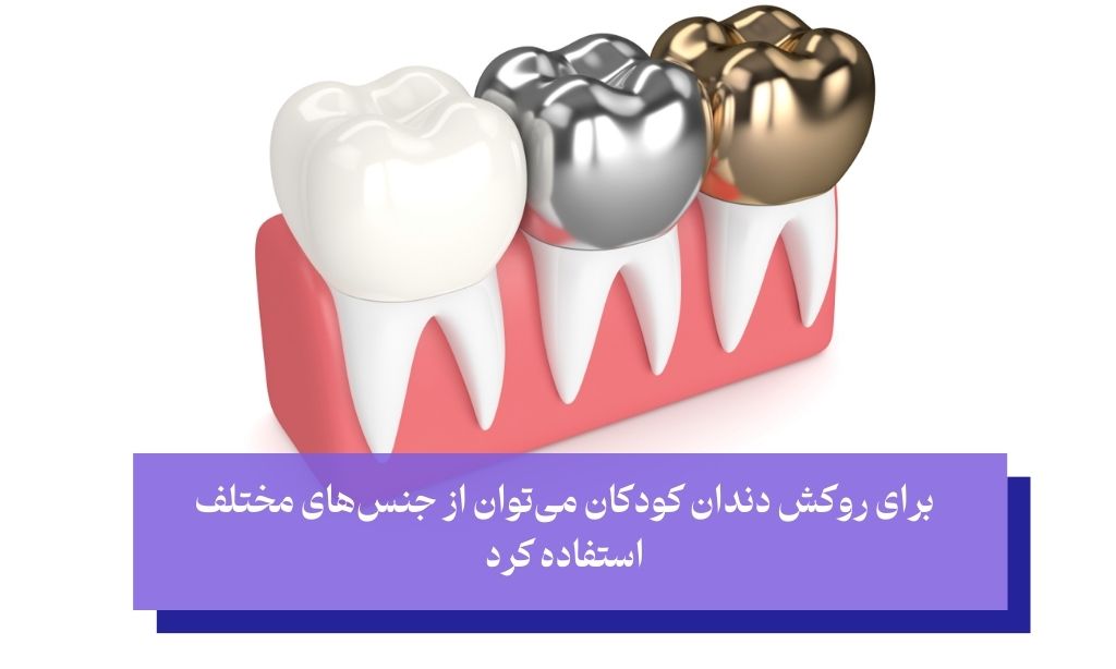 روکش دندان شیری اطفال