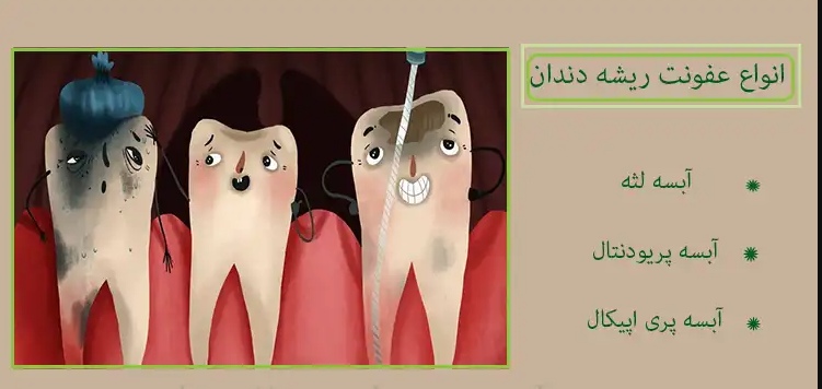 مشکلات دندان کودک