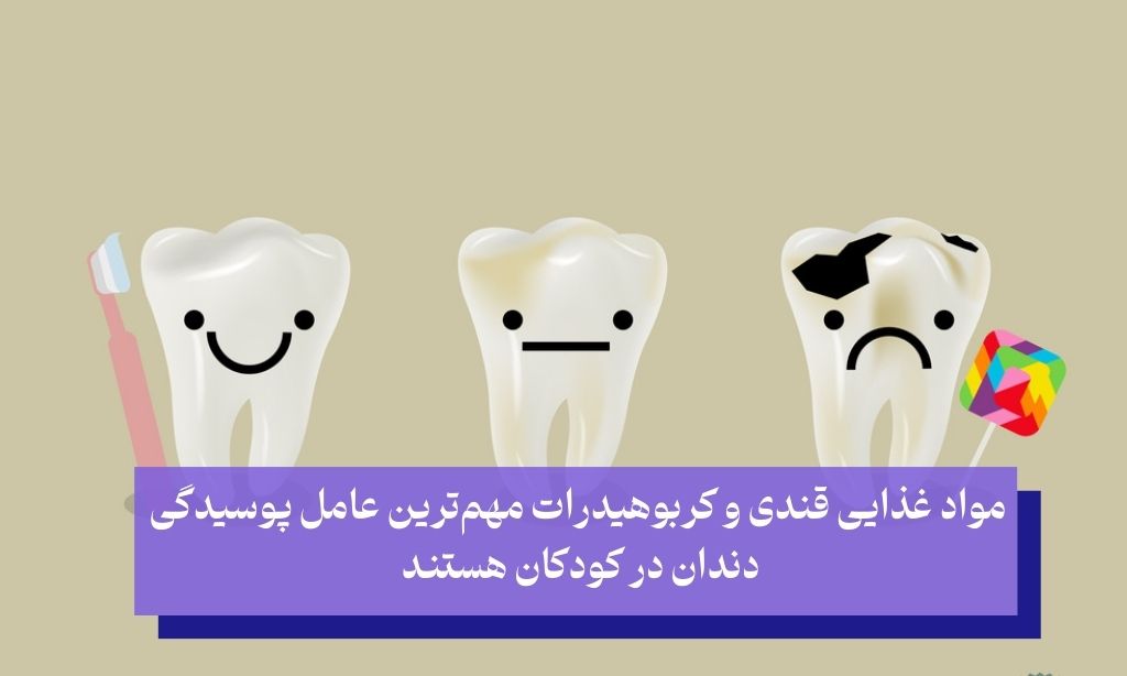 مشکلات دندان کودک