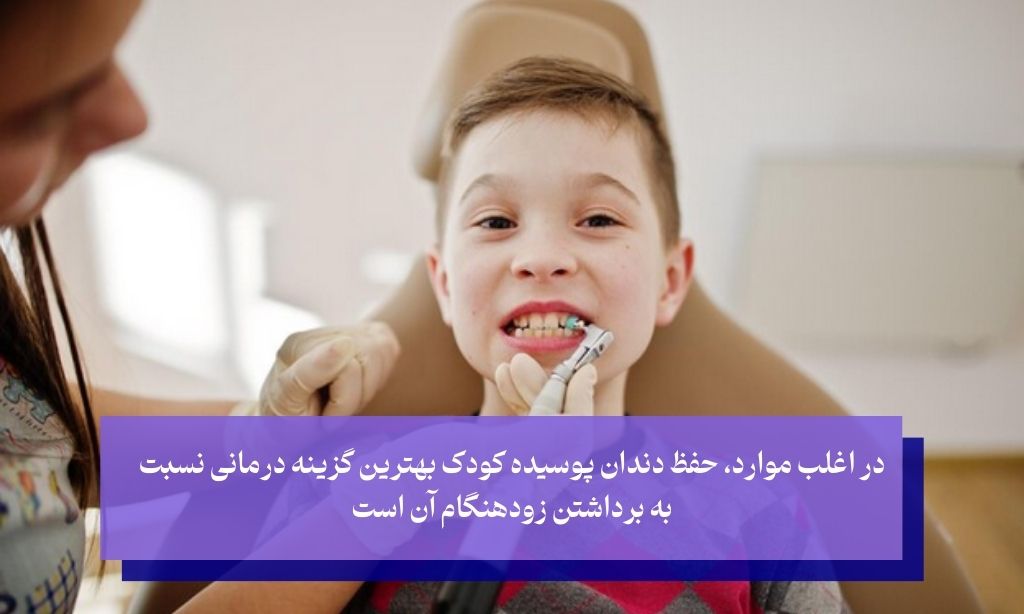 مشکلات دندان کودک