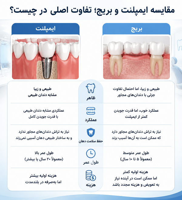 ایمپلنت بهتر است یا بریج