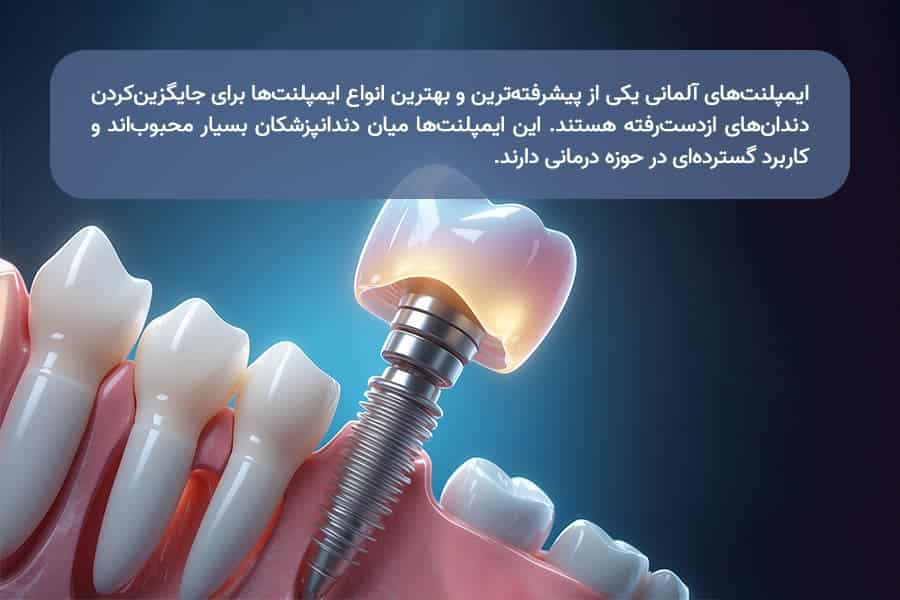بهترین برندهای ایمپلنت دندان