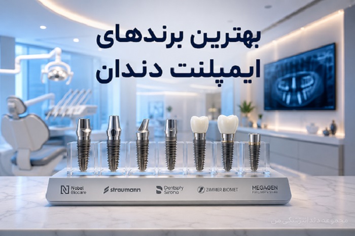 بهترین برندهای ایمپلنت دندان در تهران؛ مقایسه سوئیسی، آلمانی و کره‌ای