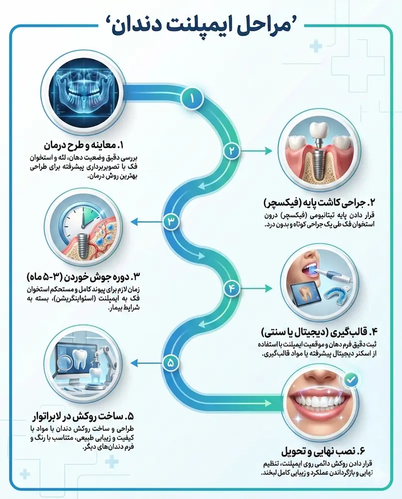 ایمپلنت دندان
