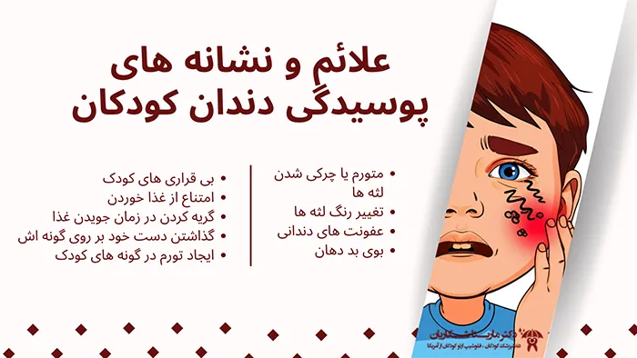پوسیدگی دندان کودک