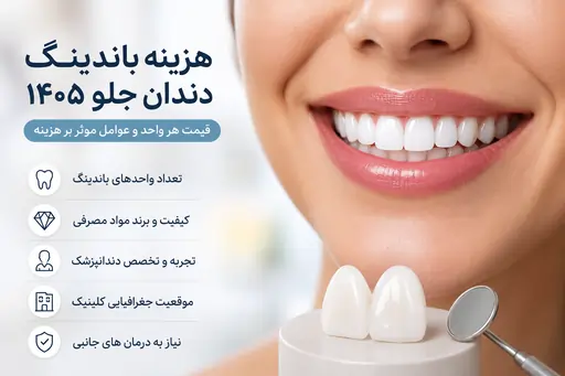 هزینه باندینگ دندان جلو ۱۴۰۵؛ قیمت هر واحد و عوامل موثر بر هزینه