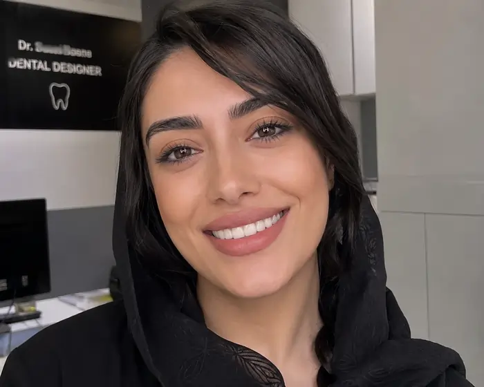 هزینه باندینگ دندان جلو ۱۴۰۵؛ قیمت هر واحد و عوامل موثر بر هزینه 2 هزینه باندینگ دندان جلو