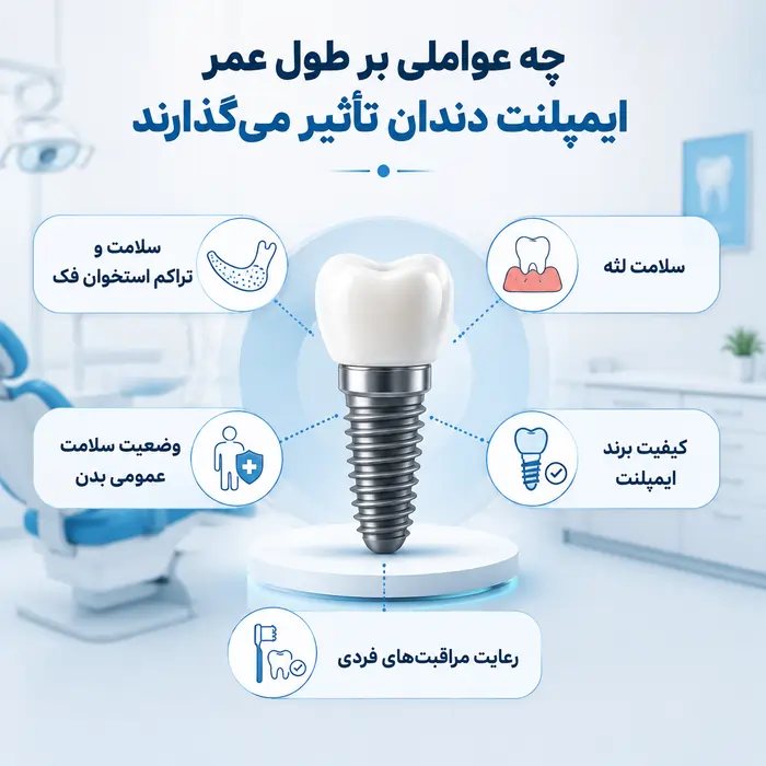 طول عمر ایمپلنت دندان