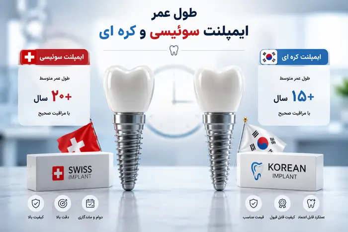 طول عمر ایمپلنت دندان