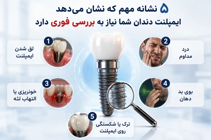 طول عمر ایمپلنت دندان