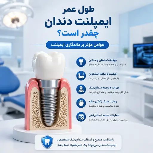 طول عمر ایمپلنت دندان چقدر است؟ عوامل مؤثر بر ماندگاری ایمپلنت