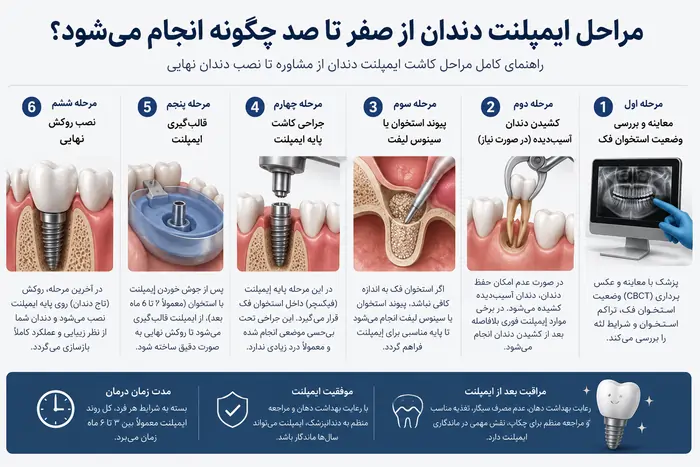مراحل ایمپلنت دندان