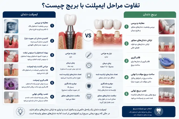 مراحل ایمپلنت دندان