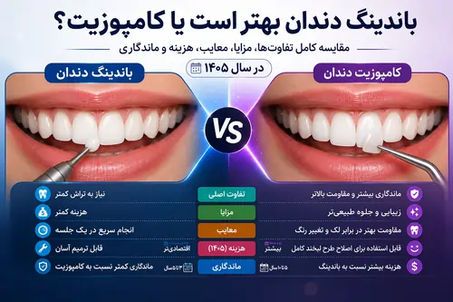 باندینگ دندان بهتر است یا کامپوزیت؟ مقایسه کامل تفاوت، مزایا، معایب، هزینه و ماندگاری در سال ۱۴۰۵
