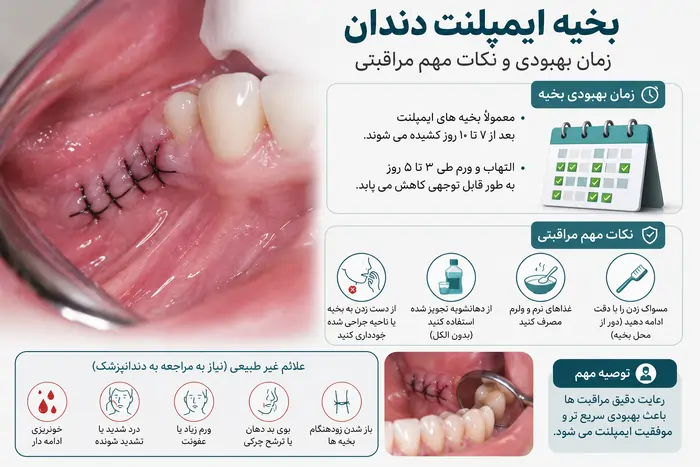 مراقبت بعد از ایمپلنت دندان
