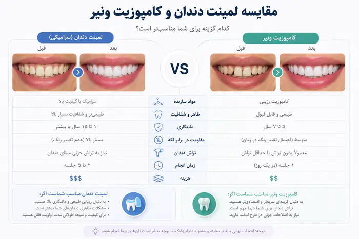 مقایسه لمینت دندان و کامپوزیت ونیر