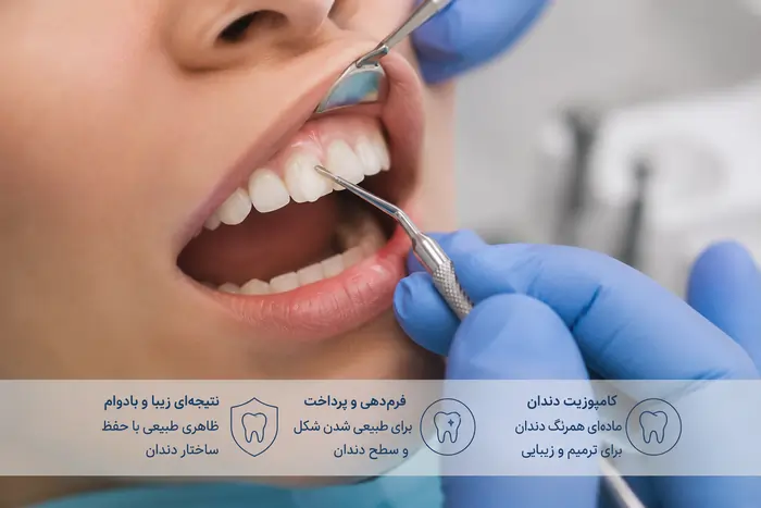 مراحل انجام کامپوزیت دندان