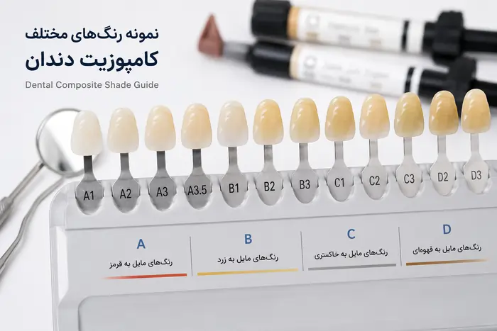 کامپوزیت دندان چیست