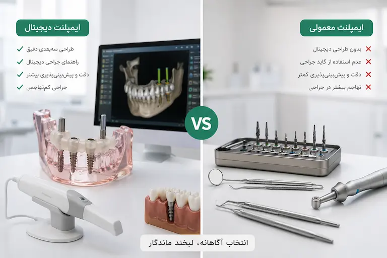 تفاوت ایمپلنت دیجیتال و معمولی چیست؟ کدام بهتر است؟