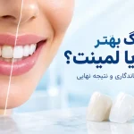 بلیچینگ بهتر است یا لمینت