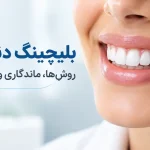 بلیچینگ دندان