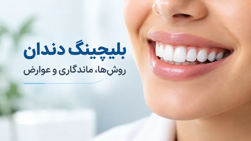 بلیچینگ دندان چیست؟ روش‌ها، هزینه، ماندگاری و عوارض