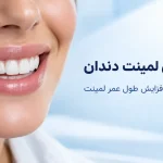 ماندگاری لمینت دندان