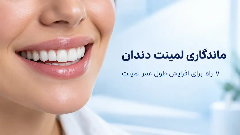 ماندگاری لمینت دندان چقدر است؟ ۷ راه افزایش طول عمر لمینت ماندگاری لمینت دندان چقدر است؟ ۷ راه افزایش طول عمر لمینت